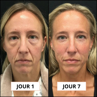 Luminea™ |  Le rituel coréen qui redonne vie à vos yeux