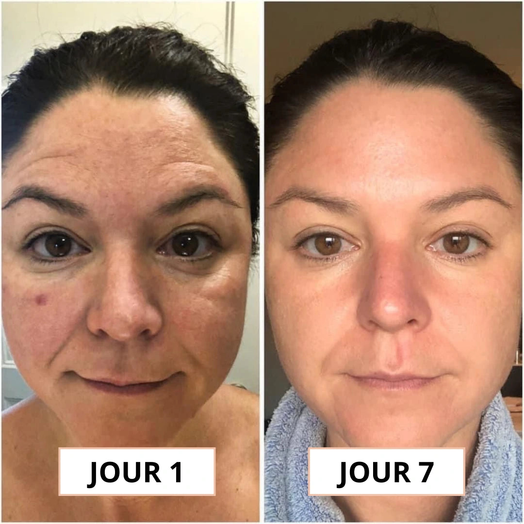 Luminea™ |  Le rituel coréen qui redonne vie à vos yeux