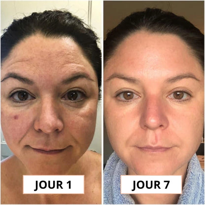 Luminea™ |  Le rituel coréen qui redonne vie à vos yeux