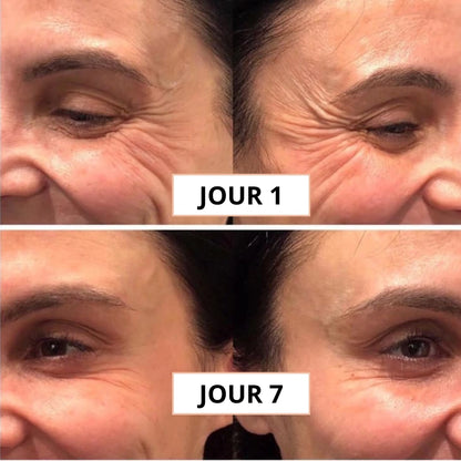 Luminea™ |  Le rituel coréen qui redonne vie à vos yeux